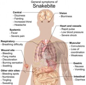 Snakebite Symptoms