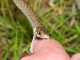 Snakebites: Two Tales of Two Cobras snakebites